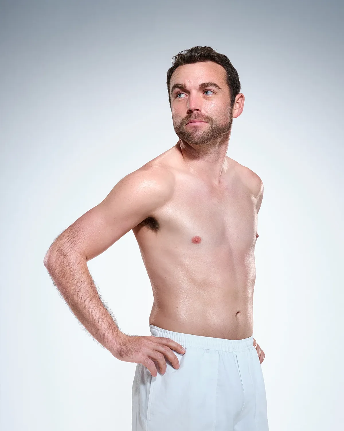 Coolsculpting Before & After