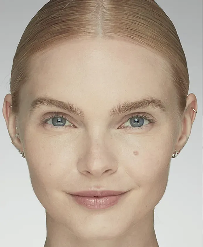 Latisse Before & After