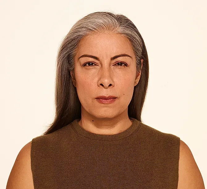 Botox Before & After