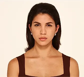 Botox Before & After