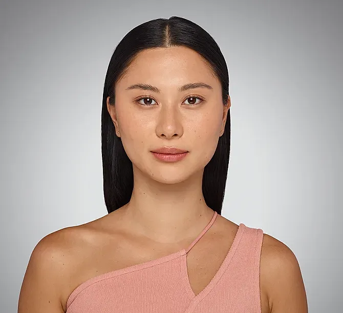 Juvederm Before & After